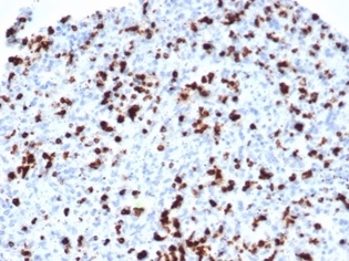 TIA1 Antibody (TIA1/1352R) - Azide and BSA Free