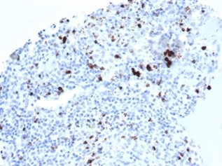 TIA1 Antibody (TIA1/1352R) - Azide and BSA Free