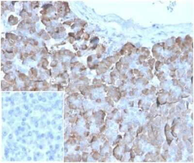 VLDLR Antibody (rVLDLR/1337) - Azide and BSA Free Immunohistochemistry-Paraffin: VLDLR Antibody (rVLDLR/1337) - Azide and BSA Free [NBP3-14200] -