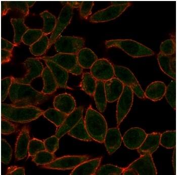 ETS2 Antibody (PCRP-ETS2-1D9) - Azide and BSA Free Immunocytochemistry/ Immunofluorescence: ETS2 Antibody (PCRP-ETS2-1D9) - Azide and BSA Free [NBP3-14209] -