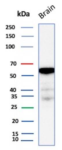 Aldehyde Dehydrogenase 1-A1/ALDH1A1 Antibody (ALDH1A1/7011R) - Azide and BSA Free Western Blot: Aldehyde Dehydrogenase 1-A1/ALDH1A1 Antibody (ALDH1A1/7011R) - Azide and BSA Free [NBP3-14211] -