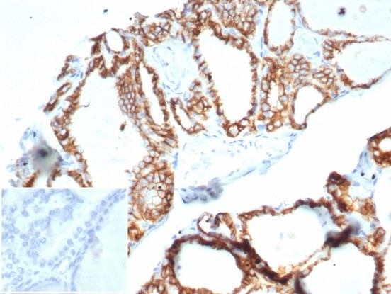 Cadherin-16 Antibody (CDH16/7028R) - Azide and BSA Free