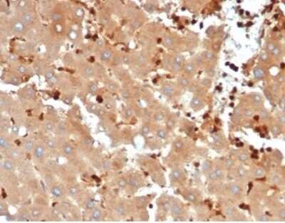 FABP5/E-FABP Antibody (FABP5/6353R) - Azide and BSA Free Immunohistochemistry-Paraffin: FABP5/E-FABP Antibody (FABP5/6353R) - Azide and BSA Free [NBP3-14216] -