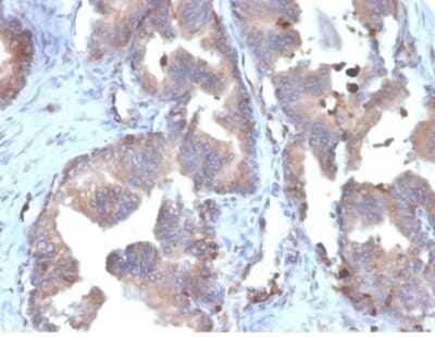 FABP5/E-FABP Antibody (FABP5/6353R) - Azide and BSA Free Immunohistochemistry-Paraffin: FABP5/E-FABP Antibody (FABP5/6353R) - Azide and BSA Free [NBP3-14216] -