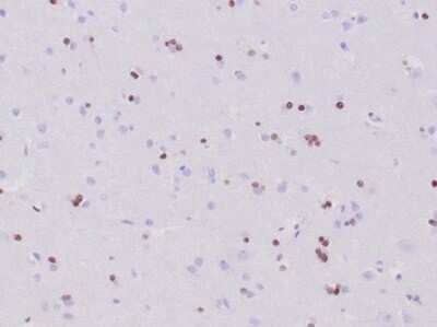 Olig2 Antibody (OLIG2/6695R) - Azide and BSA Free Immunohistochemistry-Paraffin: Olig2 Antibody (OLIG2/6695R) - Azide and BSA Free [NBP3-14217] -