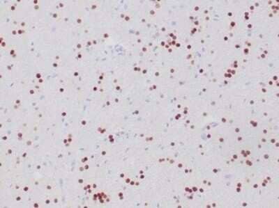 Olig2 Antibody (OLIG2/6695R) - Azide and BSA Free Immunohistochemistry-Paraffin: Olig2 Antibody (OLIG2/6695R) - Azide and BSA Free [NBP3-14217] -