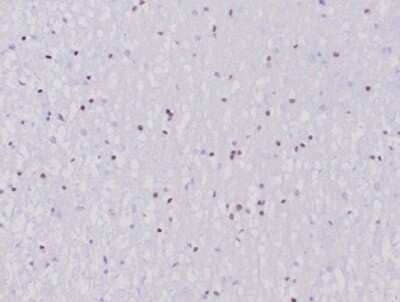 Olig2 Antibody (OLIG2/6695R) - Azide and BSA Free Immunohistochemistry-Paraffin: Olig2 Antibody (OLIG2/6695R) - Azide and BSA Free [NBP3-14217] -