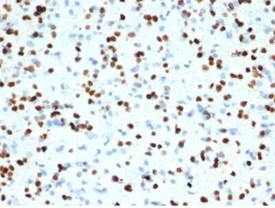 Olig2 Antibody (OLIG2/7074R) - Azide and BSA Free Immunohistochemistry-Paraffin: Olig2 Antibody (OLIG2/7074R) - Azide and BSA Free [NBP3-14218] -