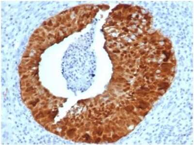 p16INK4a/CDKN2A Antibody (CDKN2A/4844R) - Azide and BSA Free Immunohistochemistry-Paraffin: p16INK4a/CDKN2A Antibody (CDKN2A/4844R) - Azide and BSA Free [NBP3-14223] -