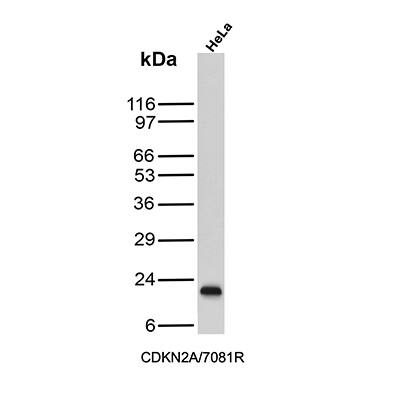 p16INK4a/CDKN2A Antibody (CDKN2A/7081R) - Azide and BSA Free Western Blot: p16INK4a/CDKN2A Antibody (CDKN2A/7081R) - Azide and BSA Free [NBP3-14227] -