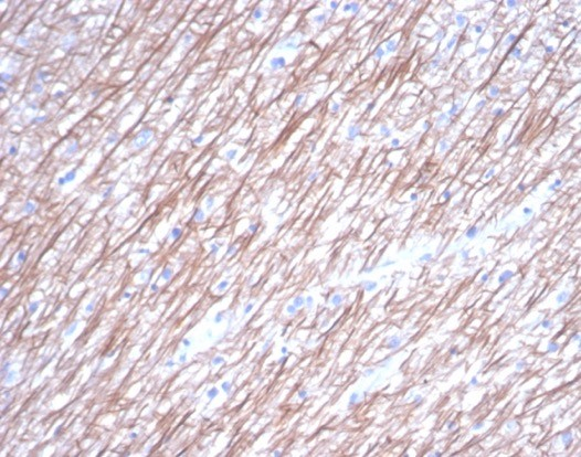 beta-III Tubulin Antibody (TUBB3/7089R) - Azide and BSA Free