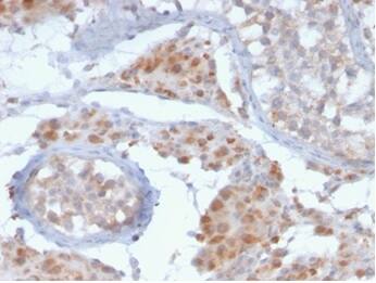 GCET2 Antibody (HGAL/2373) - Azide and BSA Free Immunohistochemistry-Paraffin: GCET2 Antibody (HGAL/2373) - Azide and BSA Free [NBP3-14265] -