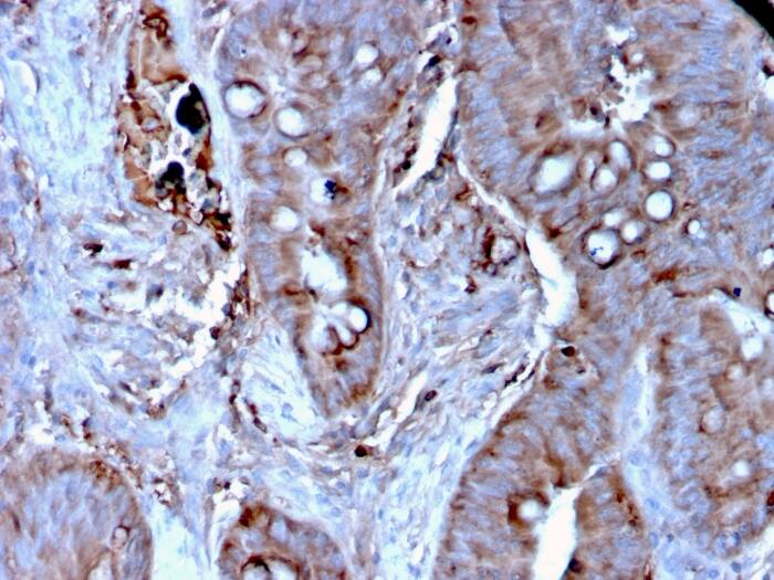 Mer Antibody (MERTK/3024) - Azide and BSA Free Immunohistochemistry-Paraffin: Mer Antibody (MERTK/3024) - Azide and BSA Free [NBP3-14269] -