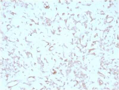 MIG2/Kindlin-2 Antibody (3A3) - Azide and BSA Free Immunohistochemistry-Paraffin: MIG2/Kindlin-2 Antibody (3A3) - Azide and BSA Free [NBP3-14275] -