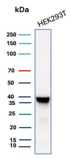 AKR1B1 Antibody (AKR1B1/7010R) - Azide and BSA Free Western Blot: AKR1B1 Antibody (AKR1B1/7010R) - Azide and BSA Free [NBP3-14284] -