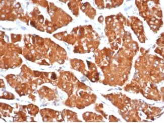 RHOBTB2 Antibody (DBC2/3361) - Azide and BSA Free Immunohistochemistry-Paraffin: RHOBTB2 Antibody (DBC2/3361) - Azide and BSA Free [NBP3-14286] -