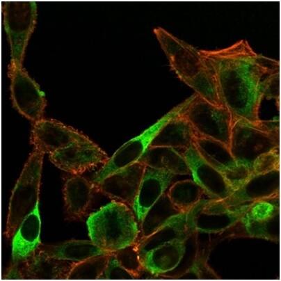 Sirtuin 3/SIRT3 Antibody (PCRP-SIRT3-1C10) - Azide and BSA Free Immunocytochemistry/ Immunofluorescence: Sirtuin 3/SIRT3 Antibody (PCRP-SIRT3-1C10) - Azide and BSA Free [NBP3-14289] -