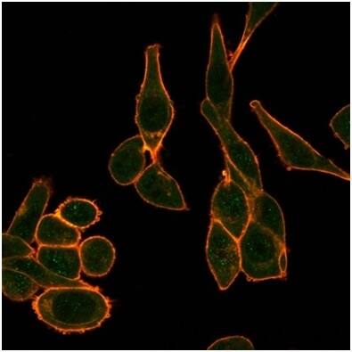Sirtuin 1/SIRT1 Antibody (PCRP-SIRT1-1E11) - Azide and BSA Free Immunocytochemistry/ Immunofluorescence: Sirtuin 1/SIRT1 Antibody (PCRP-SIRT1-1E11) - Azide and BSA Free [NBP3-14290] -