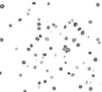 CD96 Antibody (BLR065G)