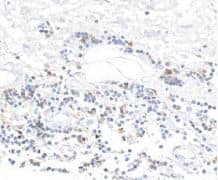 CD96 Antibody (BLR065G)