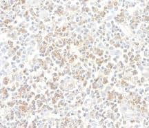 CD96 Antibody (BLR065G)