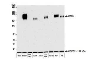 CD96 Antibody (BLR065G)