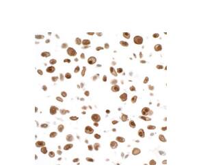 STAT3 Antibody (BLR098G)