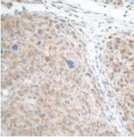 STAT3 Antibody (BLR098G)