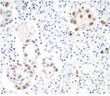 STAT3 Antibody (BLR098G)