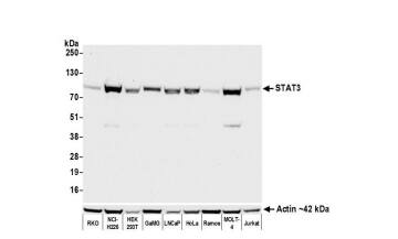 STAT3 Antibody (BLR098G)
