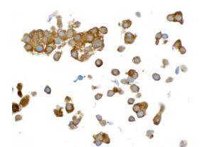 GAPDH Antibody (BLR103H)