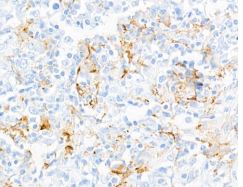 MMR/CD206/Mannose Receptor Antibody (BLR109H) MMR/CD206/Mannose Receptor Antibody (BLR109H)