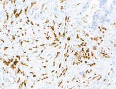 MMR/CD206/Mannose Receptor Antibody (BLR109H) MMR/CD206/Mannose Receptor Antibody (BLR109H)