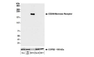 MMR/CD206/Mannose Receptor Antibody (BLR109H) MMR/CD206/Mannose Receptor Antibody (BLR109H)