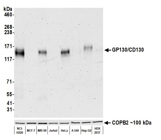 gp130/CD130 Antibody (BLR114H)