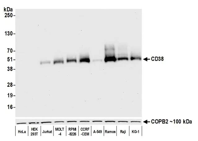 CD38 Antibody (BLR123H)