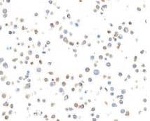 CD11c Antibody (BLR138H)