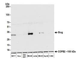 Slug Antibody (BLR139H)