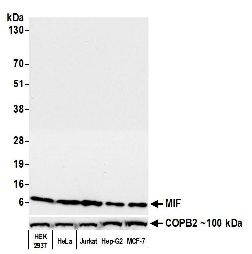 MIF Antibody (BLR141J)