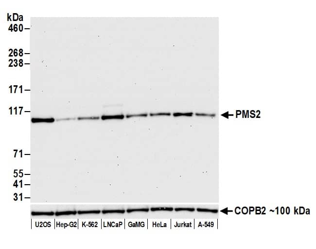 PMS2 Antibody (BLR142H)