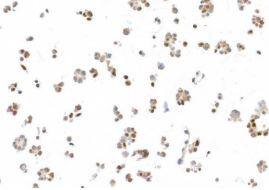 UBQLN4/CIP75 Antibody (BLR145J)