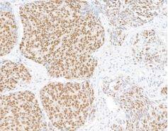 UBQLN4/CIP75 Antibody (BLR145J)