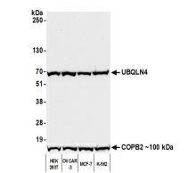 UBQLN4/CIP75 Antibody (BLR145J)