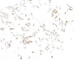 Fibroblast Activation Protein alpha/FAP Antibody (BLR150J)