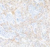 Fibroblast Activation Protein alpha/FAP Antibody (BLR150J)