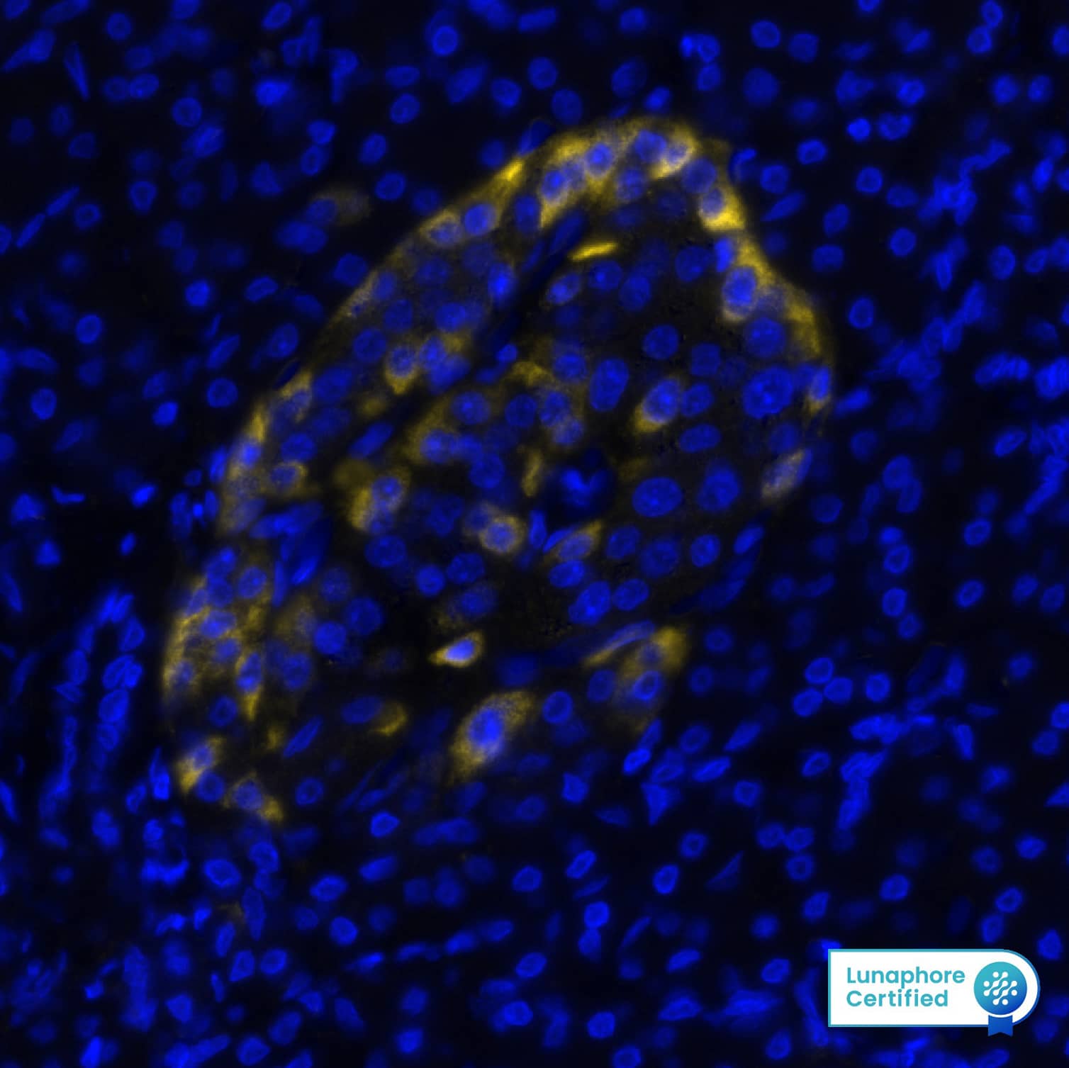 Fibroblast Activation Protein alpha/FAP Antibody (BLR150J) Detection of FAP in Human Pancreas via seqIF™ staining on COMET™
