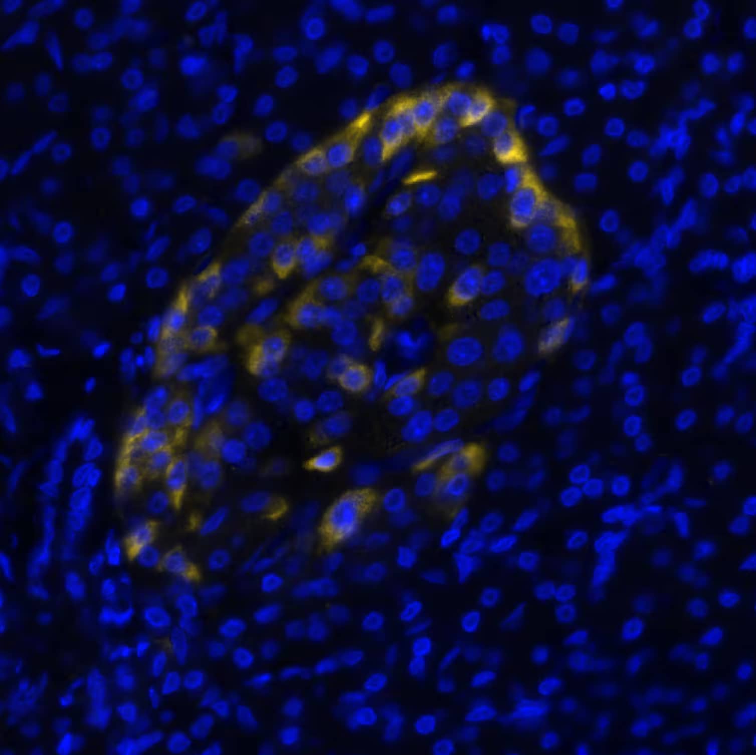 Fibroblast Activation Protein alpha/FAP Antibody (BLR150J) Detection of FAP in Human Pancreas via seqIF™ staining on COMET™