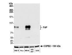 Fibroblast Activation Protein alpha/FAP Antibody (BLR150J)
