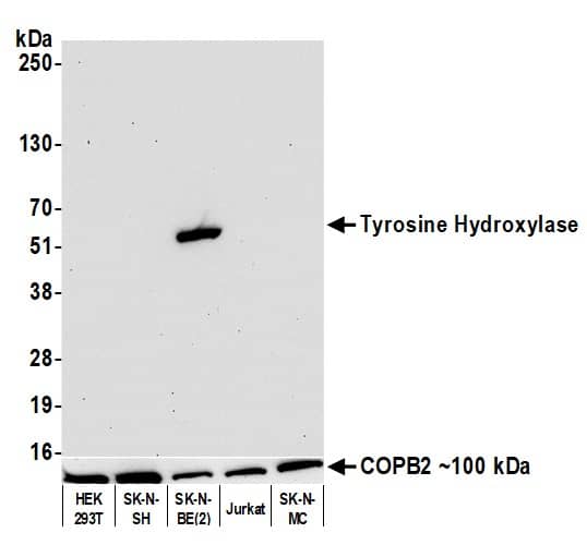 Tyrosine Hydroxylase Antibody (BLR155J)