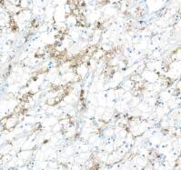 Fc gamma RIIIB/CD16b Antibody (BLR163J)